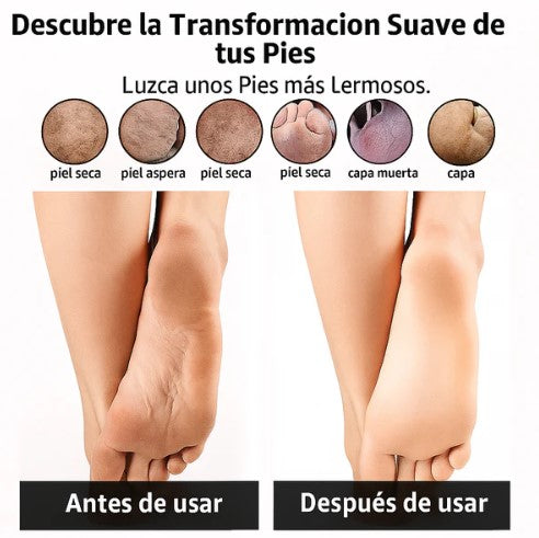 Removedor de callos inalámbrico