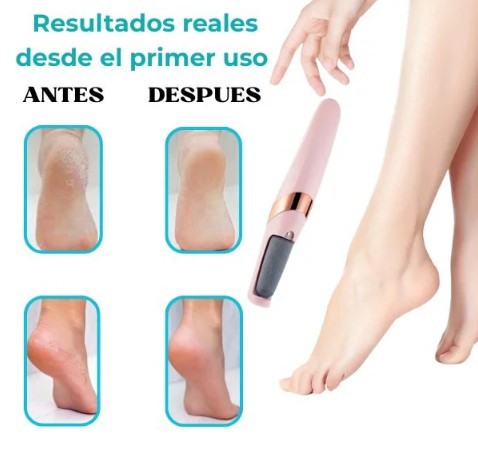 Removedor de callos inalámbrico