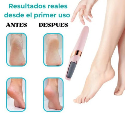 Removedor de callos inalámbrico